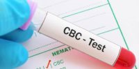 cbc test Xpress Pathlabs - pathology lab, diagnostic center, blood test, diagnostic center india, path lab, diagnostic services, pathology services, diagnostic services india, pathology services india